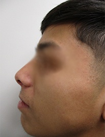 After