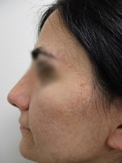 After